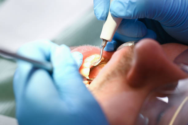 Best After-Hours Dental Trauma Care in Anadarko, OK